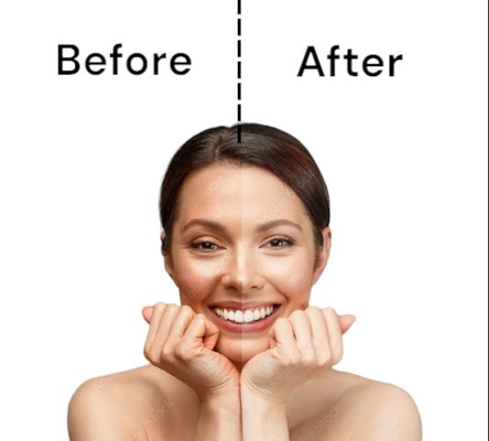 De-tan Soap / Tan Remover / Handmade Soap / Natural Soap / Sun Damaged Skin / Sun Tanning Remover / Treats Acne / Rashes Farmula / Smooth Skin / Pack Of 1 Soap